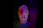 Haber yaparken saldırıya uğrayan muhabir yaralandı