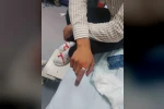 Parmağında sıkışan yüzük itfaiye ekiplerince kesildi