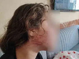 8 yaşındaki kızını darp eden çocuğun epilepsi hastası ablasını sokak ortasında dövdüğü iddiası
