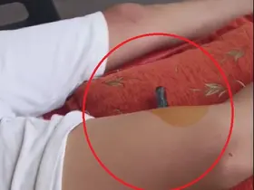 Bahçeye kaçan topu almak isteyen çocuğun bacağına korkuluk demiri saplandı
