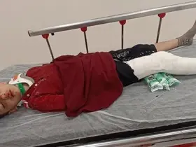Başakşehir’de 8 yaşındaki çocuğa trafiğe kapalı alanda motosiklet çarptı: Baba yardım istedi
