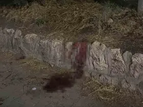 Bıçaklı kavgada 17 yaşındaki çocuk ağır yaralandı
