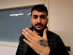 Dövme sildirmek isterken kabusu yaşadı, elindeki dokular öldü
