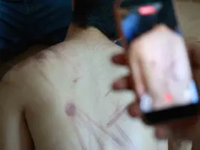 Down sendromlu oğlunun vücudundaki izleri görünce soluğu önce hastanede ardından adliyede aldı
