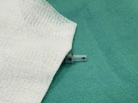 Matkap kullanırken fırlayan vida parçası gözünden ediyordu: "Gözlük kullanmadım böyle oldu"
