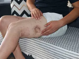 (ÖZEL) Kendisine iyilik yapmaya çalışan akrabasını önce vurdu, sonra da icra davası açtı
