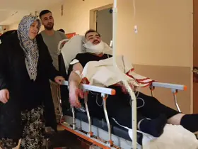 Tartıştığı kuzenini falçata ile yüzünden yaraladı
