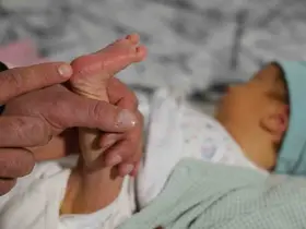 Topuk kanı çıkmazı: Bebeklerine kayyum atanması endişesiyle yaşıyorlar
