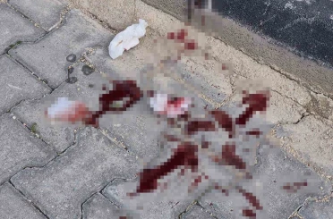 16 yaşındaki çocuk caddede bacağından bıçaklandı 