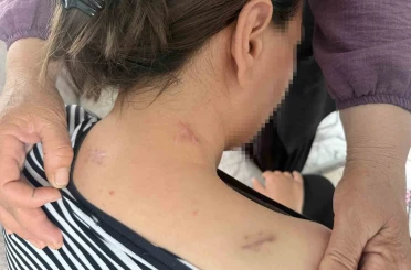 17 bıçak darbesi aldı, ölü numarasıyla kurtuldu, kocasının en ağır cezayı almasını istedi 