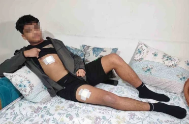 Akran zorbalığı az kalsın öldürüyordu: Önce dövüldü sonra bıçaklandı 