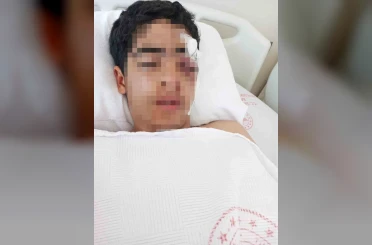 Akran zorbalığına bir yenisi eklendi: 15 yaşındaki çocuk muştayla öldüresiye dövüldü 