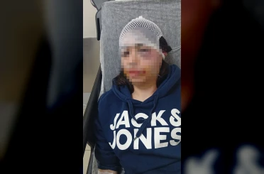 Ayrılık kararını kabullenemeyip kız arkadaşını darbeden sanık: "Çok üzgünüm" 