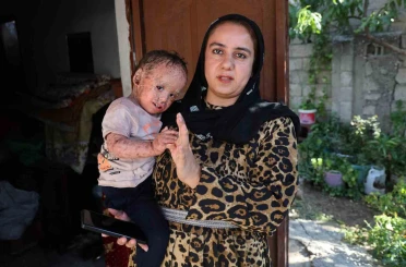 Balık pulu ve kelebek hastası Yusuf’un yardım paralarını dolandırıcılar topladı 