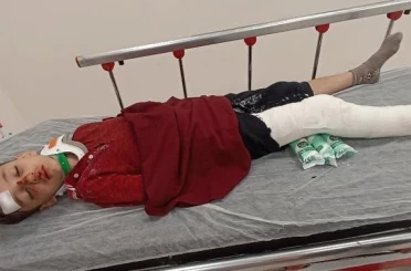 Başakşehir’de 8 yaşındaki çocuğa trafiğe kapalı alanda motosiklet çarptı: Baba yardım istedi