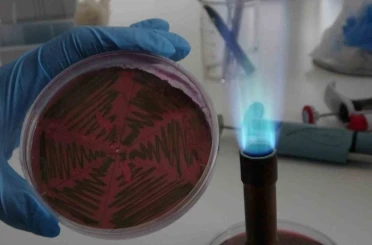 Çiğ süt, gıdayla bulaşan idrar yolu enfeksiyonlarına kapı açıyor 