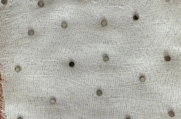 Çocuğun boğazından 19 adet mıknatıs çıkartıldı 