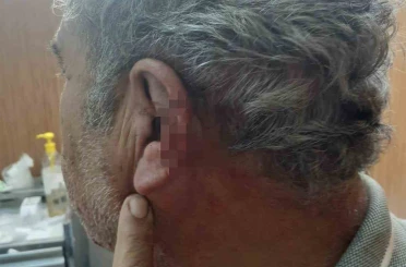 Doktor ile emekli öğretmenin mesai kavgası karakolda bitti 