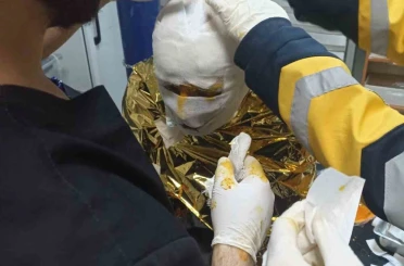 Erzincan’da kömür ocağında yangın: 2 işçi yaralı 