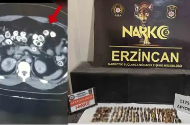 Erzincan’da uyuşturucuyu vücutlarında taşıyan 3 şüpheli yakalandı