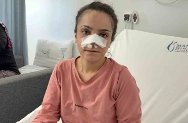 Eşinin kopardığı burnu başarılı operasyonla yerine dikildi 