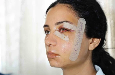 Eski eşini dövüp serbest kalan şüpheli tutuklandı 