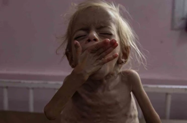 Gazze’de 2 kişi daha açlıktan hayatını kaybetti 