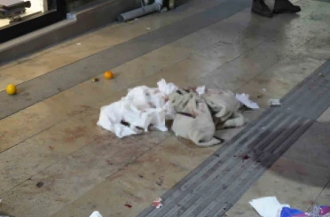 Gümüşhane’de boşanma aşamasındaki eşi tarafından bıçaklanan kadın yaralandı 