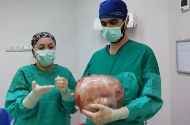 Karnı 2 ayda 9 aylık hamile gibi büyüyen kadının içinden karpuz kadar kitle çıkarıldı 