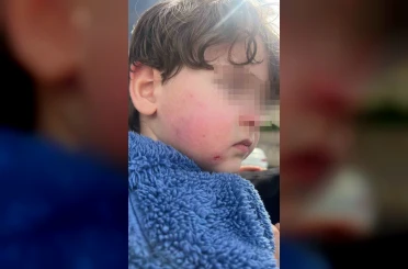 Kreşe bıraktığı çocuğunu darp edilmiş halde aldı 