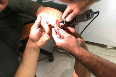 Mardin’de bir kişinin parmağında sıkışan yüzük itfaiye ekiplerince çıkartıldı 