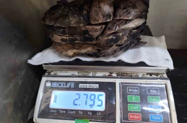Nefes darlığı şikayeti ile hastaneye gitti, göğsünden 3 kilogramlık tümör çıktı 