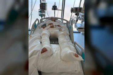 Otomobilin çarptıktan sonra üzerinden geçtiği genç kız ağır yaralandı 
