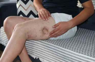 (ÖZEL) Kendisine iyilik yapmaya çalışan akrabasını önce vurdu, sonra da icra davası açtı 