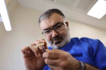 Özelde 8 bin TL olan kaplama, devlet hastanesinde 188 TL’ye yapılmaya başladı 