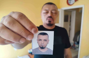 Saçlarını siyahlatmak için aldığı şampuan arı sokmasından beter hale getirdi 