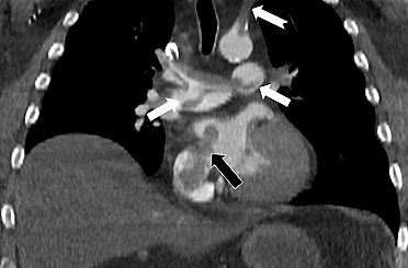 Tekden’de başarılı çalışmalara imza atan radyoloji uzmanından hayati tespit 