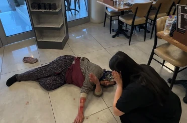 Tekmelere aldırmayan köpek kadının kolunu kopardı 