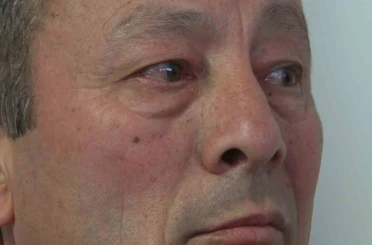 Ümraniye’deki ikinci cinayette acılı baba fenalaşarak hastaneye kaldırıldı 