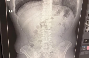 Uşak’ta midelerinden uyuşturucu çıktı: İranlı 3 kişi tutuklandı 