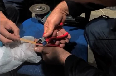 Vatandaşın parmağına yüzük sıkışan yüzüğü itfaiye çıkardı 