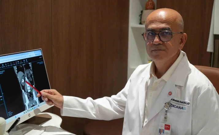25 cm küplük böbrek taşı, hastanın sırtından girilerek çıkartıldı 