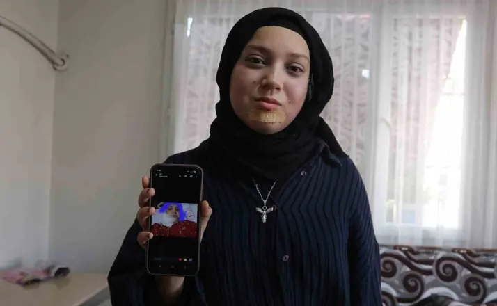 Kanseri yenen Buse’nin hayali kendisi gibi hastalara umut olmak
