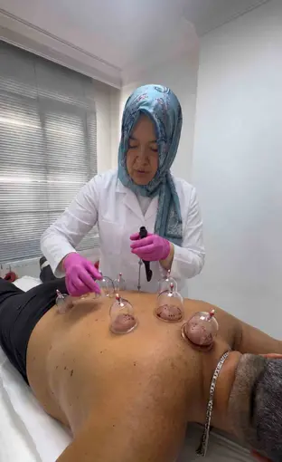 Dr. Esra Çetin Timur’dan hacamat uyarısı: "Bu uygulamayı hekim bizzat yapmalı"
