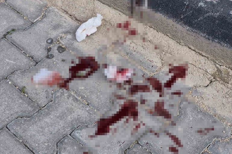 16 yaşındaki çocuk caddede bacağından bıçaklandı 