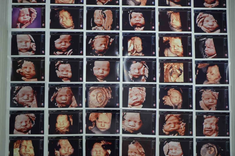 7 yıllık bebek hasreti "kişiye özel" tedaviyle son buldu