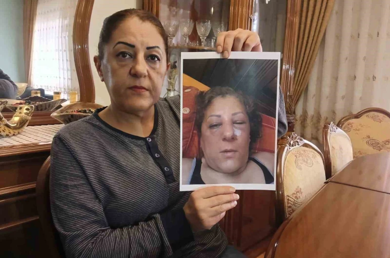 Apartman bahçesinde beslediği kediler nedeniyle komşuları tarafından darbedilen kadının burnu kırıldı