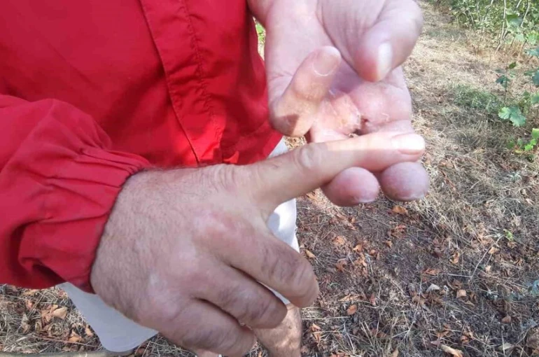 Ayının saldırısına uğrayan çiftçi dehşet anlarını anlattı: "Parmağımı kopardı"