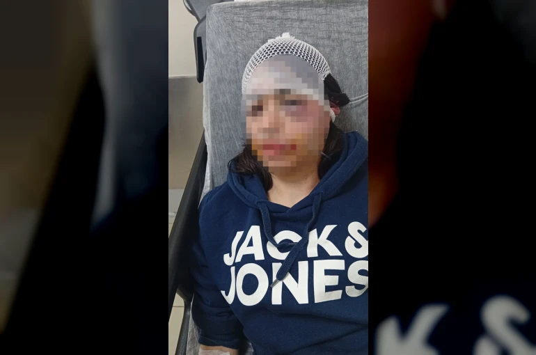 Ayrılık kararını kabullenemeyip kız arkadaşını darbeden sanık: "Çok üzgünüm" 
