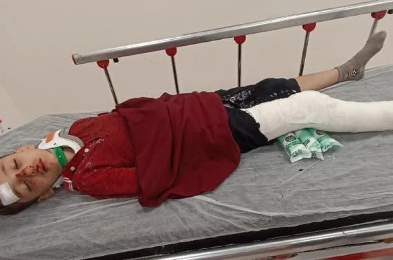 Başakşehir’de 8 yaşındaki çocuğa trafiğe kapalı alanda motosiklet çarptı: Baba yardım istedi 